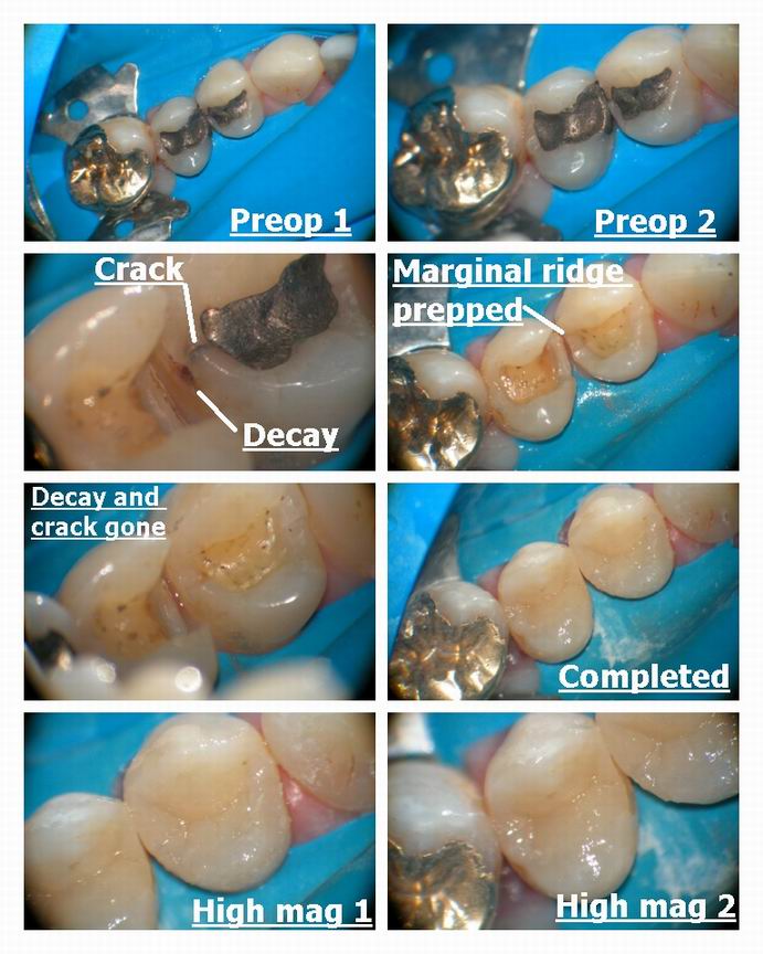 Resize of Two composites edited.jpg